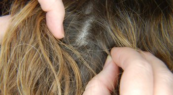 Lice inspection